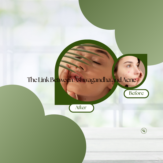 The Link Between Ashwagandha and Acne