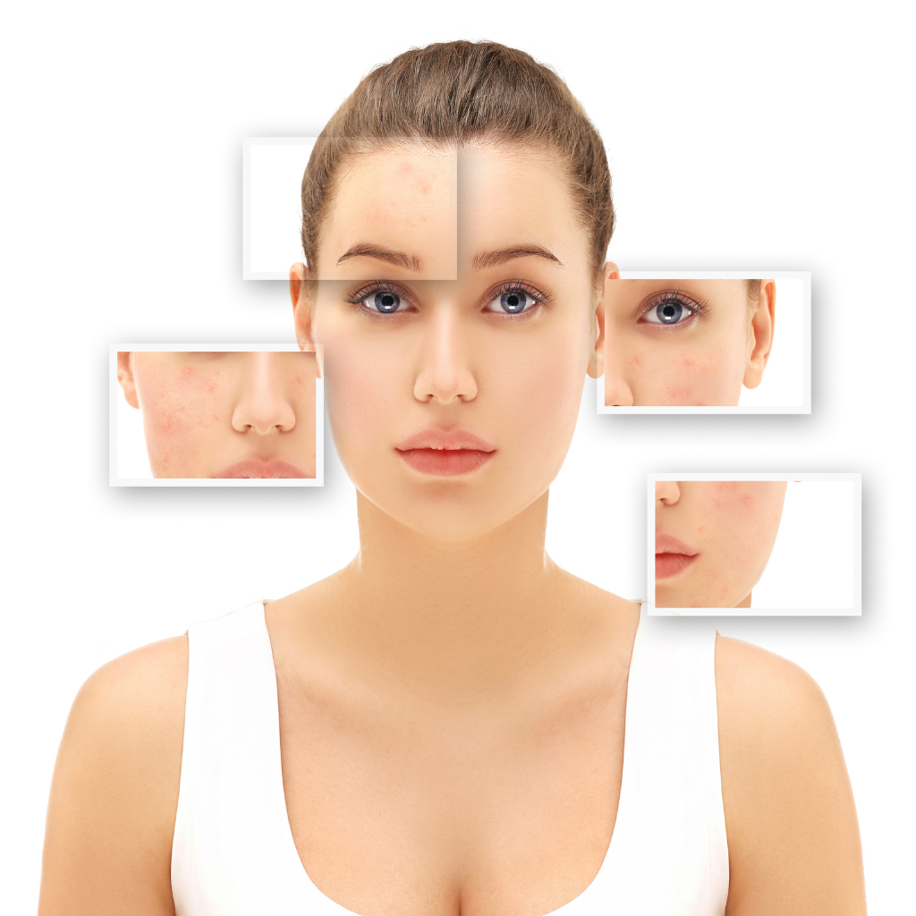 why doesn't dirt stick to scars