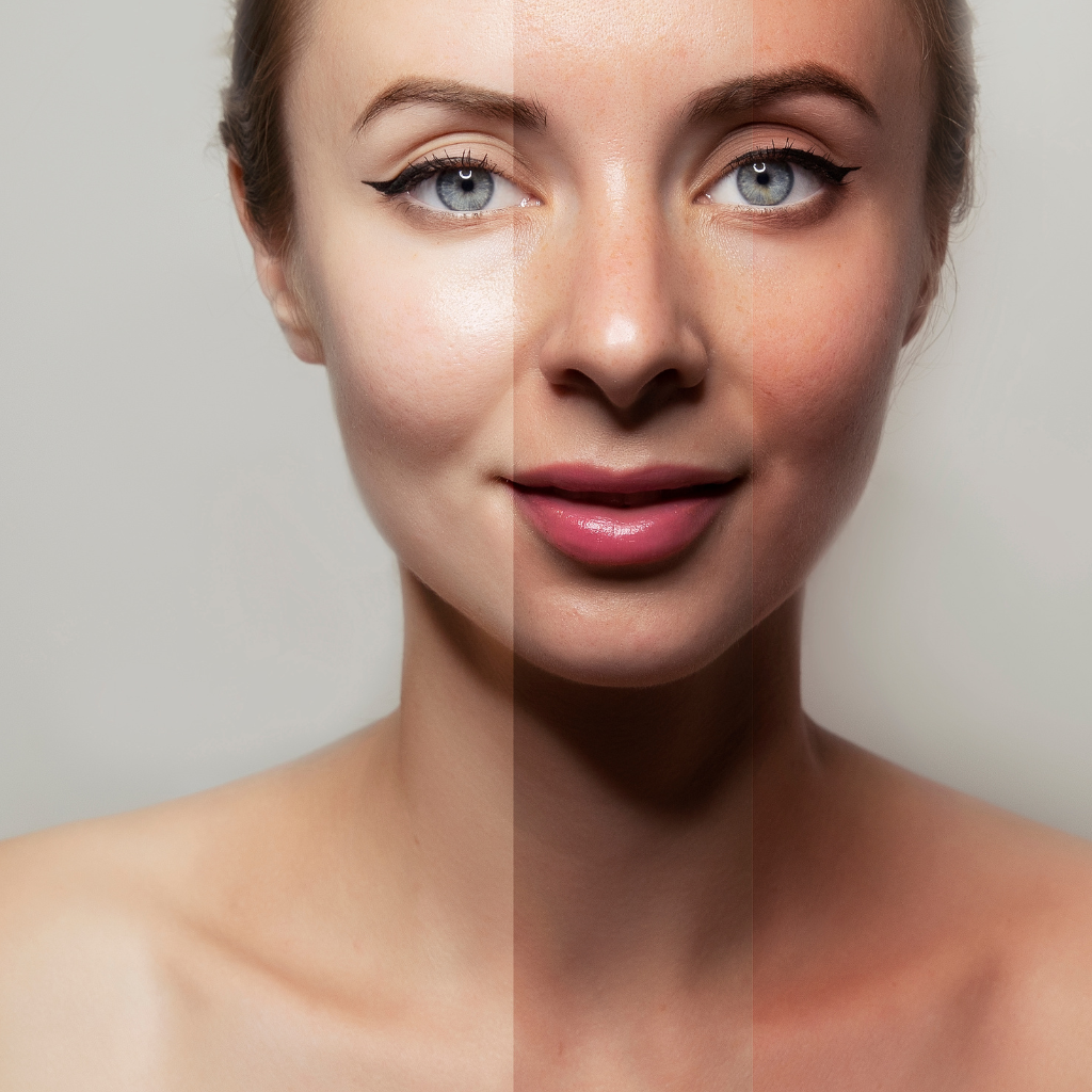 The Debate: Pale Skin vs Tan