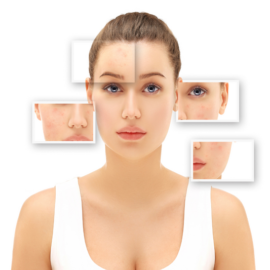 why doesn't dirt stick to scars