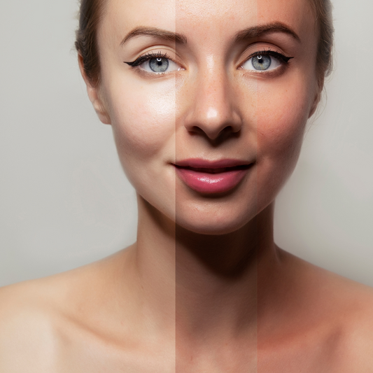 The Debate: Pale Skin vs Tan