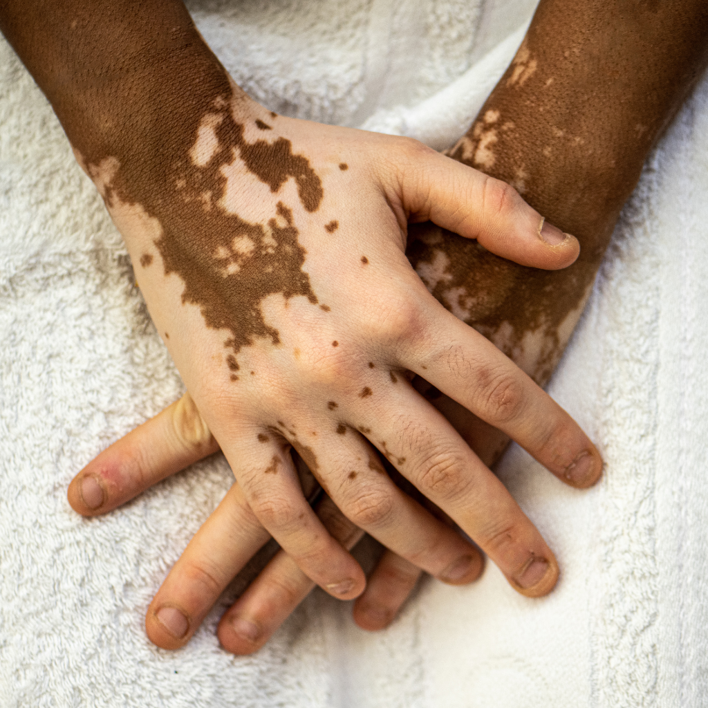 Tips for Describing Different Skin Tones