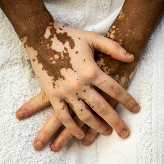 Tips for Describing Different Skin Tones