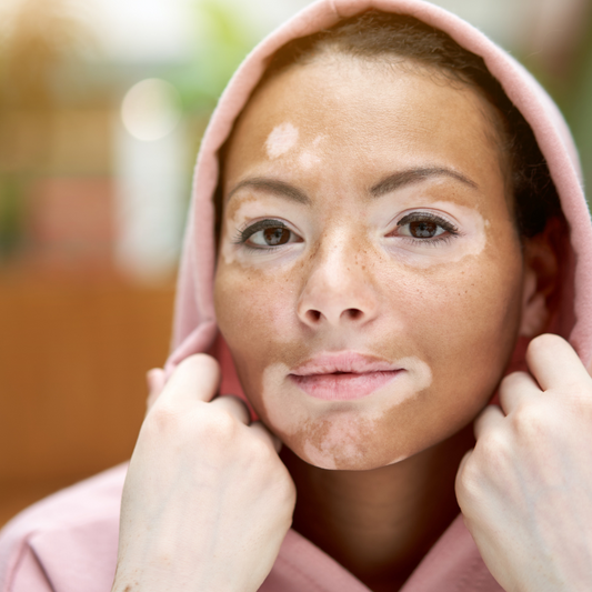 Pigmentation Creams for Brighter Skin