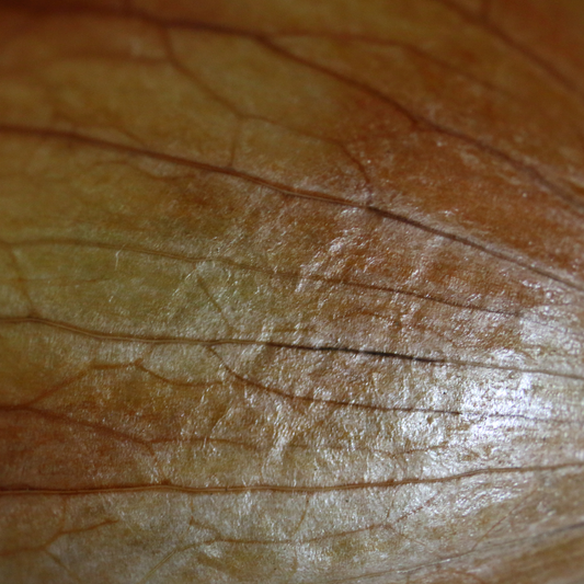 The Benefits of Onions for Skin