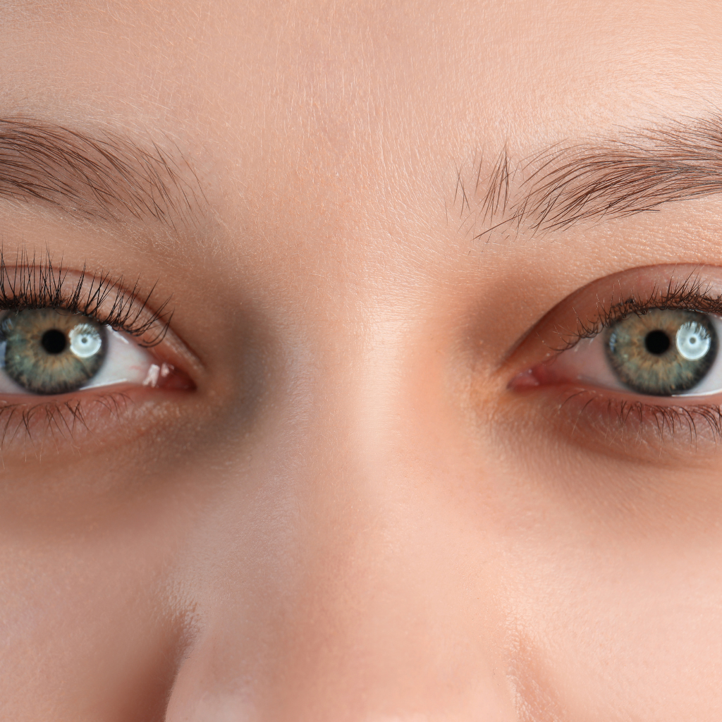 Essential oils for dark circles and puffy eyes