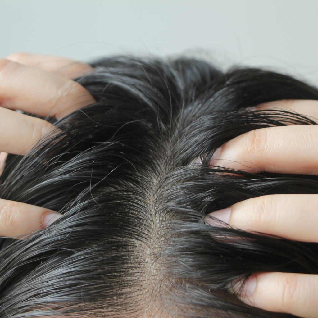 Top 10 Tips for Managing Greasy Hair