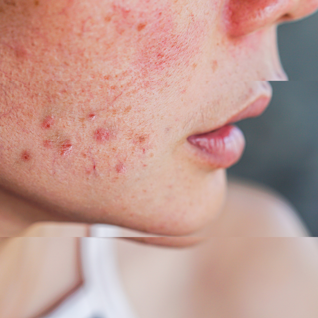 Face Washes for Sensitive Skin