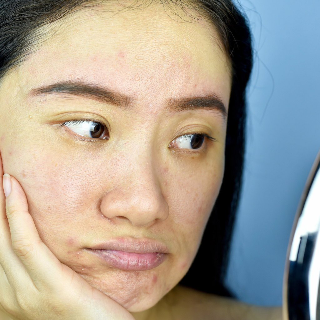 Top 10 Natural Remedies for Dull Skin